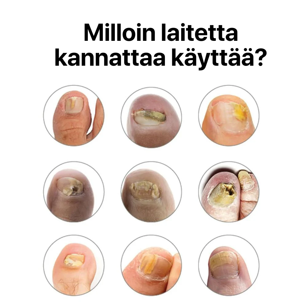 NörviaCare® Laserlaite kynsille